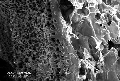 Scanning electron micrograph showing an injured lung repaired with MeTro gel, a strong and stretchy non-toxic surgical glue.